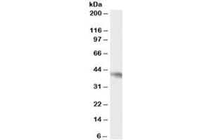Western blot testing of Daudi cell lysate with NCF4 antibody at 0. (NCF4 Antikörper)