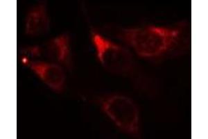 ABIN6275540 staining NIH-3T3 cells by IF/ICC. (TAO Kinase 1 (TAOK1) (Internal Region) Antikörper)
