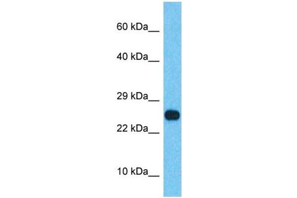 Synovial Sarcoma, X Breakpoint 2B (SSX2B) (N-Term) Antikörper