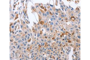 Immunohistochemistry (IHC) image for anti-Neuregulin 4 (NRG4) antibody (ABIN2828341) (Neuregulin 4 Antikörper)