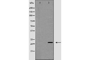 Western blot analysis of MGMT expression in Jurkat cells. (MGMT Antikörper  (N-Term))