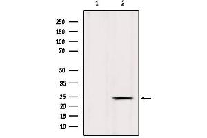 Western blot analysis of extracts from Mouse liver, using ICT1 Antibody. (ICT1 Antikörper)