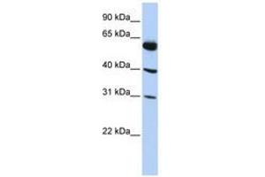 Image no. 1 for anti-LysM, Putative Peptidoglycan-Binding, Domain Containing 4 (LYSMD4) (AA 35-84) antibody (ABIN6741208) (LYSMD4 Antikörper  (AA 35-84))