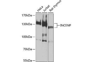 Western blot analysis of extracts of various cell lines, using INCENP antibody (ABIN6130494, ABIN6142441, ABIN6142442 and ABIN6213904) at 1:1000 dilution. (INCENP Antikörper  (AA 785-914))