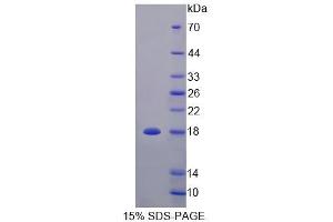 SDS-PAGE analysis of Rat TNFRSF25 Protein. (DR3/LARD Protein)