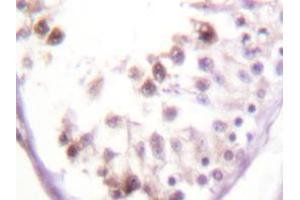 Immunohistochemistry analyzes of HDAC6 antibody in paraffin-embedded human testis tissue. (HDAC6 Antikörper)