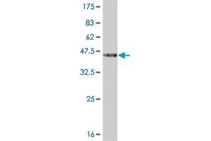 Western Blot detection against Immunogen (36. (PKNOX1 Antikörper  (AA 2-100))
