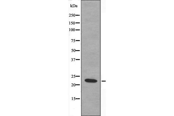 MRPS17 Antikörper  (Internal Region)