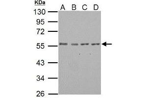 WB Image IP6K1 antibody detects IP6K1 protein by western blot analysis. (IP6K1 Antikörper)