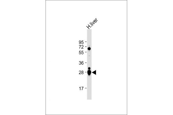 GSTa2 anticorps  (N-Term)