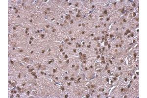 IHC-P Image NFIB antibody [N1C2] detects NFIB protein at nucleus on mouse fore brain by immunohistochemical analysis. (NFIB Antikörper)