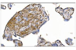 IHC analysis of MERTK using anti-MERTK antibody (ABIN7600623). (MERTK Antikörper  (AA 21-489))