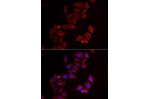 Immunofluorescence analysis of MCF7 cells using LIMS1 antibody (ABIN6132049, ABIN6143233, ABIN6143235 and ABIN6222007). (LIMS1 Antikörper  (AA 1-325))