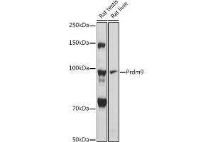 Western blot analysis of extracts of various cell lines, using Prdm9 antibody (ABIN7269502) at 1:1000 dilution. (PRDM9 Antikörper)