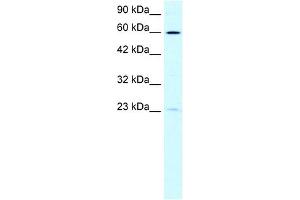 WB Suggested Anti-SUPT3H Antibody Titration: 0. (SUPT3H/SPT3 Antikörper  (N-Term))