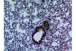 Immunohistochemistry (IHC) image for anti-Dihydropyrimidine Dehydrogenase (DPYD) (Internal Region) antibody (ABIN3187761)