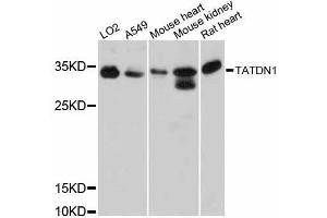 Western blot analysis of extracts of various cell lines, using TATDN1 antibody (ABIN5999010) at 1:3000 dilution. (TATDN1 Antikörper)