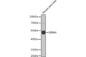 Western Blotting (WB) image for anti-Glutamate Receptor, Ionotropic, N-Methyl D-Aspartate-Associated Protein 1 (Glutamate Binding) (GRINA) (AA 1-100) antibody (ABIN7267422)