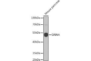 Western blot analysis of extracts of Mouse pancreas, using GRINA antibody (ABIN7267422) at 1:1000 dilution.