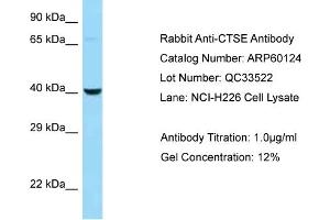 Western Blotting (WB) image for anti-Cathepsin E (CTSE) (N-Term) antibody (ABIN2788342)