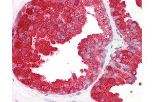 Anti-ACPP antibody IHC of human prostate. (ACPP Antikörper  (AA 269-282))