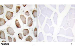Immunohistochemistry analysis of paraffin-embedded human skeletal muscle using DUS2L polyclonal antibody .