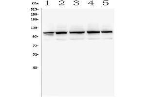 Western blot analysis of TRPC5 using anti-TRPC5 antibody (ABIN6719380).