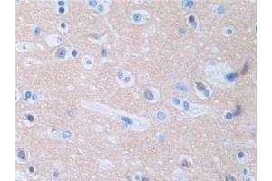 #VALUE! (Protein Phosphatase 3, Regulatory Subunit 1 (AA 2-170) Antikörper)