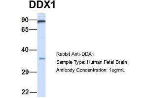 Host:  Rabbit  Target Name:  DDX1  Sample Type:  Human Fetal Brain  Antibody Dilution:  1. (DDX1 Antikörper  (Middle Region))