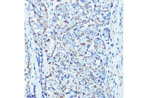 Immunohistochemistry of paraffin-embedded rat kidney using ATPB Rabbit mAb (ABIN7265722) at dilution of 1:100 (40x lens). (ATP5B Antikörper)