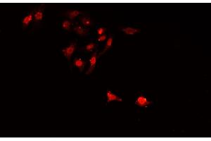 ABIN6268997 staining A549 cells by IF/ICC.