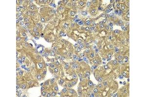 Immunohistochemistry of paraffin-embedded Rat kidney using PSMD5 Polyclonal Antibody at dilution of 1:100 (40x lens). (PSMD5 Antikörper)