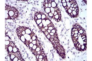Immunohistochemistry (IHC) image for anti-LI Cadherin (AA 600-707) antibody (ABIN5542556)