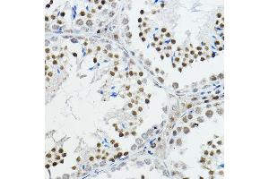 Immunohistochemistry of paraffin-embedded mouse testis using NCOR1 Rabbit pAb (ABIN6130574, ABIN6144420, ABIN6144421 and ABIN6222831) at dilution of 1:100 (40x lens). (NCOR1 Antikörper  (AA 1-200))