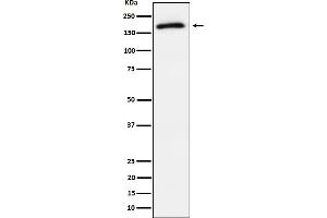 Western blot analysis of Phospho-AS160 (T642) expression in 293T treated with insulin cell lysate.