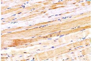 IHC analysis of MYH6 using anti-MYH6 antibody (ABIN7603070).