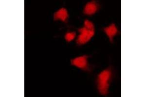 ABIN6269060 staining K562 by IF/ICC. (JAK2 Antikörper  (C-Term))