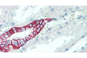 Immunohistochemistry of paraffin-embedded Kidney tissue using SCN10A Polyclonal Antibody at dilution of 1:100. (Nav1.8 Antikörper)