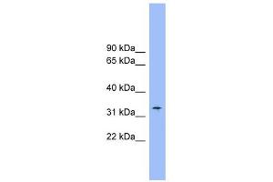 SLC25A1 antibody used at 1 ug/ml to detect target protein. (Slc25a1 Antikörper)