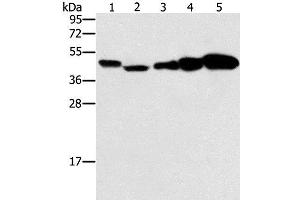 Western Blot analysis of Hela, Raji, Jurkat, A549 and NIH/3T3 cell using PPAT Polyclonal Antibody at dilution of 1:250