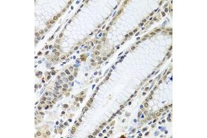 Immunohistochemistry of paraffin-embedded human stomach using TIA1 antibody at dilution of 1:100 (40x lens).