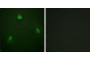 Immunofluorescence analysis of NIH-3T3 cells, using Pin1 (Ab-1619) Antibody.
