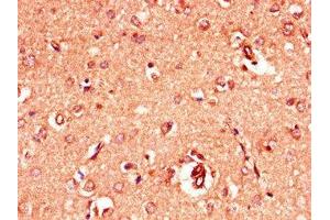 Immunohistochemistry of paraffin-embedded human brain tissue using ABIN7153965 at dilution of 1:100 (GRIA4 Antikörper  (AA 733-883))
