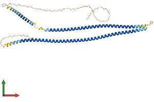 Protein Structure (PS) image for Keratin 13 (KRT13) (AA 1-437) protein (His tag) (ABIN7562762)