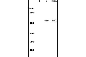 Lane 1: mouse embryo lysates Lane 2: human colon carcinoma lysates probed with Anti RBPJK/RBP-J Polyclonal Antibody, Unconjugated (ABIN872972) at 1:200 in 4C.