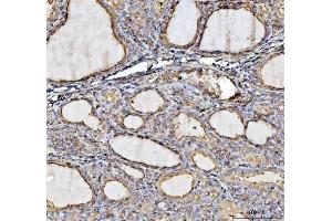 IHC analysis of Annexin VI/ANXA6 using anti-Annexin VI/ANXA6 antibody (ABIN5692982). (ANXA6 Antikörper  (AA 395-665))