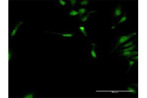 Immunofluorescence of purified MaxPab antibody to DYX1C1 on HeLa cell. (DYX1C1 Antikörper  (AA 1-381))