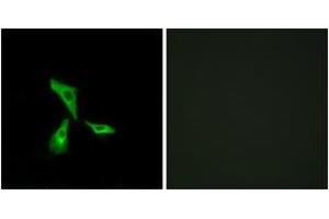 Immunofluorescence analysis of HeLa cells, using GPR101 Antibody. (GPR101 Antikörper  (AA 451-500))