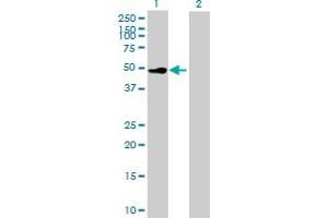 Western Blot analysis of CSF2RA expression in transfected 293T cell line by CSF2RA MaxPab polyclonal antibody.