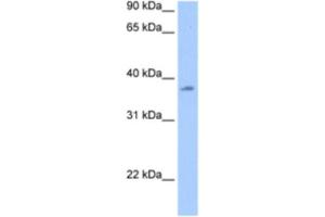 Western Blotting (WB) image for anti-RNA Binding Motif Protein, Y-Linked Family 1 Member A1 (RBMY1A1) antibody (ABIN2462072) (RBMY1A1 Antikörper)